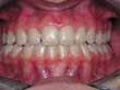 Dr. Schoonover -- Orthodontics (After)