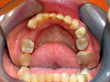 Dr. Schoonover -- Orthodontics (After)